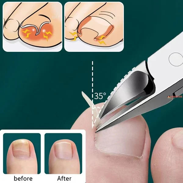 NailCare Pro™ - Toe Nail Cutter