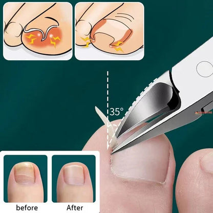 NailCare Pro™ - Toe Nail Cutter